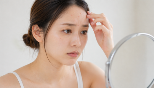 粉瘤とニキビの見分け方｜症状・原因・治療の違いを徹底解説