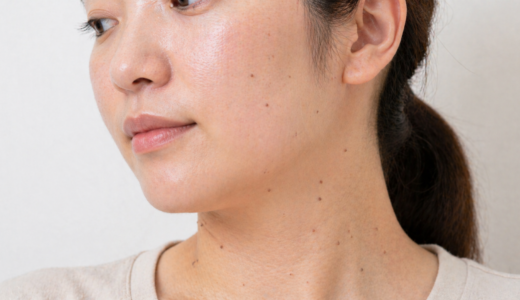 イボが自然に取れた！その理由と再発を防ぐための正しい対処法