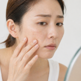 顔のシミを気にして頬を触っている女性