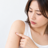 腕にできたデキモノを気にして触れる女性