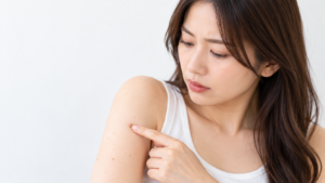 腕にできたデキモノを気にして触れる女性