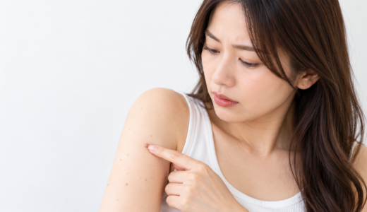 体にイボができる病気の種類と原因・治療法を解説