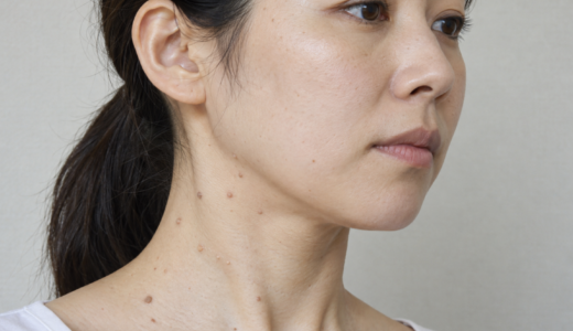 若い人の首にできるイボの原因と対処法を徹底解説