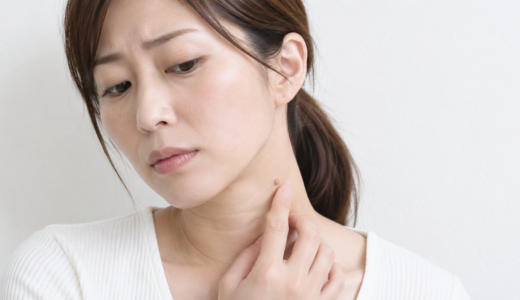 イボとホクロの違いを徹底解説｜見分け方・原因・治療法まで